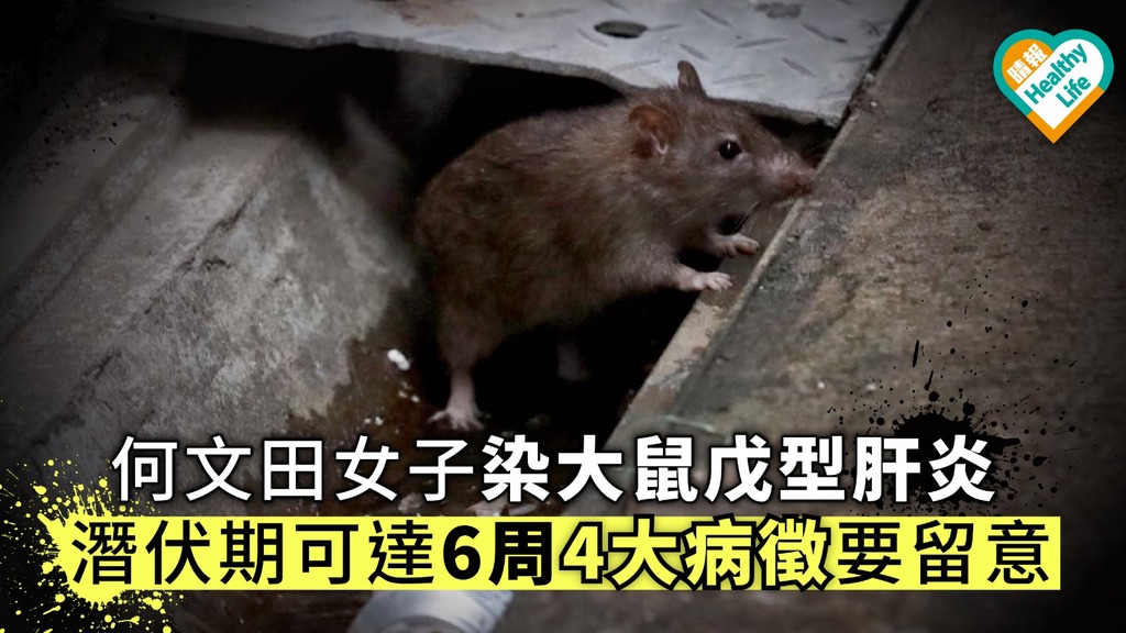 大鼠戊型肝炎｜紅磡42歲男子感染大鼠戊型肝炎　屬本地個案　留醫10天後出院