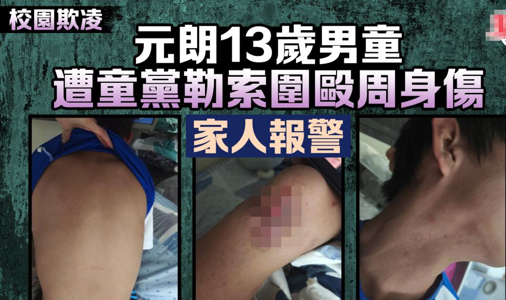 元朗13岁中学生被指“勾二嫂”惨遭多名同学集体欺凌殴打浑身是伤，還指其“挖墙角”被勒索2.5萬元！港警以“自称三合會成員”等四罪名拘捕6名男女童，最小的才12岁！